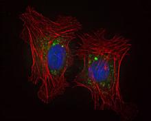 Image of green nanoparticles entering two red cells and releasing their drug payload. Image of green nanoparticles entering two red cells and releasing their drug payload.