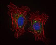 Image of green nanoparticles entering two red cells and releasing their drug payload.