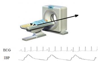 A computer generated diagram of a patient in an MRI machine with ECG and IBP waves below