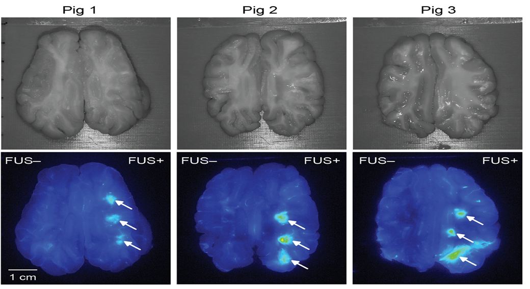 immunotherapy delivered to pig brain image of pig brain slides with and without ultrasound and drug delivery