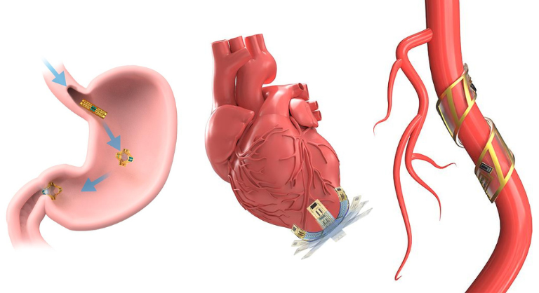 A graphic showing illustrations of a soft robot wrapping around an artery, a soft robot gripping a heart, and a soft robot inside the stomach