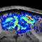 Harel_Cover_Laminar-fMRI_thumb.jpg Thumbnail