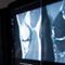 mri2 CAI2R thumb.jpg Thumbnail