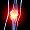 osteoarthritisthumb.jpg Thumbnail