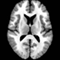 MRI images for males and females are arranged in order of increasing patient age from 30 to 60.