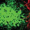 fluorescent image of cancer cell invading a blood vessel