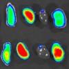 Selective binding of tagged nanoparticle to macrophages in tumors