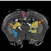difference in stiffness after stimulus