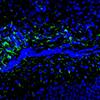 brain cell section showing green astrocytes