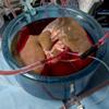 A liver in a large blue vat submerged in liquid and hooked up to the machine profusion system