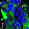 Green fluorescent protein delivered into kidney cells