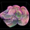 A 3D image of intestines colored pink with spots of yellow and some green shading.