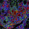 Muscle cells stained with fluorescent molecules