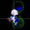Microscopy image of natural killer cells attacking cancer cells 