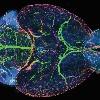 An image of a mouse brain with the vasculature stained with green and pink