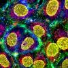 A microscopic image showing yellow circles with a green and blue background