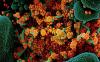 COVID-19 virus
