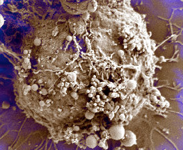 tumor releasing extracellular vesicles tumor releasing extracellular vesicles