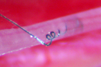 Carbon nanotube yarn embedded in rat vagus nerve 